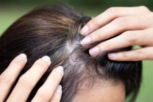 imagen cuidado capilar