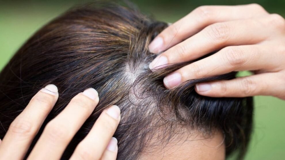 imagen cuidado capilar