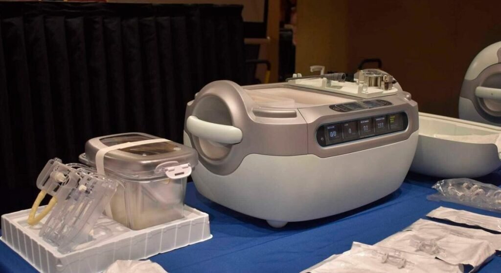 Trasplantes renales en Argentina