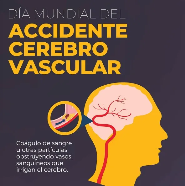 Asistente Virtual para ACV